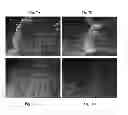 Fig. 08 - NANOPARTICLES BASED FOR DERMAL AND SYSTEMIC DELIVERY OF DRUGS