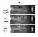 Fig. 07 - Protein skeletal module which increases the binding affinity and binding specificity of active polypeptides