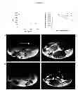 Fig. 04 - CELLULOSE-BASED NANOPARTICLES FOR DRUG DELIVERY