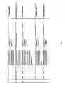 Fig. 32 - Antibacterial phage, phage peptides and methods of use thereof