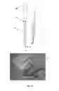 Fig. 09 - Methods For Treating Baldness And Promoting Hair Growth