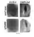 Fig. 06 - Therapeutic applications targeting SARM1