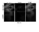 Fig. 07 - Therapeutic applications targeting SARM1