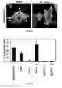 Fig. 02 - Compositions and Methods to Prevent Cell Transformation and Cancer Metastasis