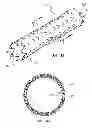 Fig. 04 - Electrospun material covered medical appliances and methods of manufacture