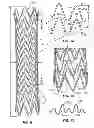 Fig. 08 - Electrospun material covered medical appliances and methods of manufacture