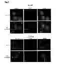 Fig. 04 - METHODS FOR TREATING HEPATOCELLULAR CARCINOMA