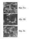 Fig. 06 - METHODS TO TREAT NERVOUS SYSTEM CONDITIONS