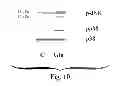 Fig. 11 - METHODS TO TREAT NERVOUS SYSTEM CONDITIONS