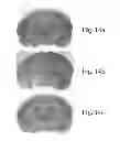 Fig. 15 - METHODS TO TREAT NERVOUS SYSTEM CONDITIONS