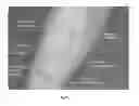 Fig. 02 - X-ray contrast media compositions and methods of using the same