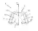 Fig. 01 - FUNCTIONAL DENTOFACIAL ORTHOPEDIC APPARATUS