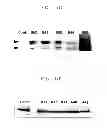 Fig. 06 - Compositions and kits comprising a membrane permeable marker that is converted into a detectable marker inside a microvesicle, and methods for detecting and analyzing microvesicle