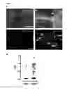 Fig. 02 - Means and methods for diagnosing and treating multiple sclerosis