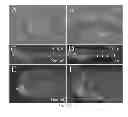 Fig. 20 - Class of near infrared optical probes for biological applications