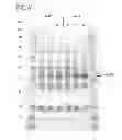 Fig. 09 - Biosynthesis of human milk oligosaccharides in engineered bacteria