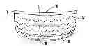 Fig. 01 - Swimsuit with enhanced buttock portion