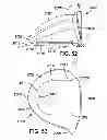 Fig. 24 - Golf club head