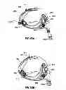 Fig. 29 - Golf club head
