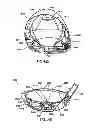 Fig. 30 - Golf club head