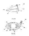 Fig. 35 - Golf club head