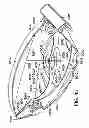 Fig. 48 - Golf club head