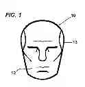 Fig. 02 - MARTIAL ARTS TRAINING DEVICE