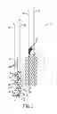 Fig. 04 - Multifunctional exercise machines