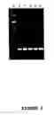 Fig. 02 - METHOD FOR THE DETECTION AND/OR IDENTIFICATION OF A MICROORGANISM