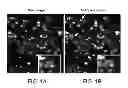 Fig. 02 - Identification of compounds that disperse TDP-43 inclusions