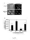 Fig. 16 - Acetyltanshinone IIA (ATA) as anticancer agent