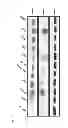 Fig. 03 - Modulation of phosphatidylinositol-5-phosphate-4-kinase activity