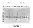 Fig. 06 - ANTISENSE OLIGONUCLEOTIDES FOR INDUCING EXON SKIPPING AND METHODS OF USE THEREOF