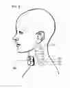 Fig. 08 - Methods and devices for treating primary headache
