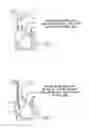 Fig. 02 - Percutaneous right ventricular assist apparatus and method