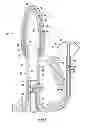 Fig. 06 - URINARY INCONTINENCE DEVICE
