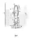 Fig. 07 - URINARY INCONTINENCE DEVICE