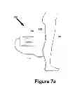 Fig. 12 - Non-invasive sensor apparatus and method for assessing cardiac performance