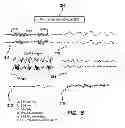 Fig. 22 - Method and apparatus for measuring biopotential and mapping ephaptic coupling employing a catheter with MOSFET sensor array