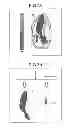 Fig. 07 - Ultrasonic diagnostic apparatus and image processing apparatus