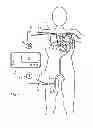 Fig. 02 - Apparatus and Method for determining a volume amount of a physiological volume