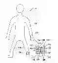 Fig. 01 - METHOD AND APPARATUS FOR DETERMINING AT LEAST ONE PREDETERMINED MOVEMENT OF AT LEAST ONE PART OF A BODY OF A LIVING BEING