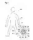 Fig. 02 - METHOD AND APPARATUS FOR DETERMINING AT LEAST ONE PREDETERMINED MOVEMENT OF AT LEAST ONE PART OF A BODY OF A LIVING BEING