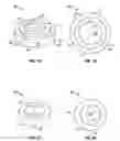 Fig. 02 - Lip suction device and related methods
