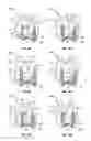 Fig. 06 - Lip suction device and related methods