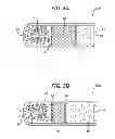 Fig. 06 - Chondrocyte Container and Method of Use