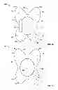 Fig. 02 - Devices and methods for treating accidental bowel leakage