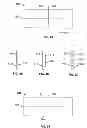 Fig. 09 - Devices and methods for treating accidental bowel leakage