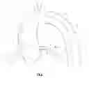 Fig. 02 - Collarless guide extension catheter