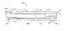 Fig. 01 - PRESSURE SENSING GUIDEWIRE